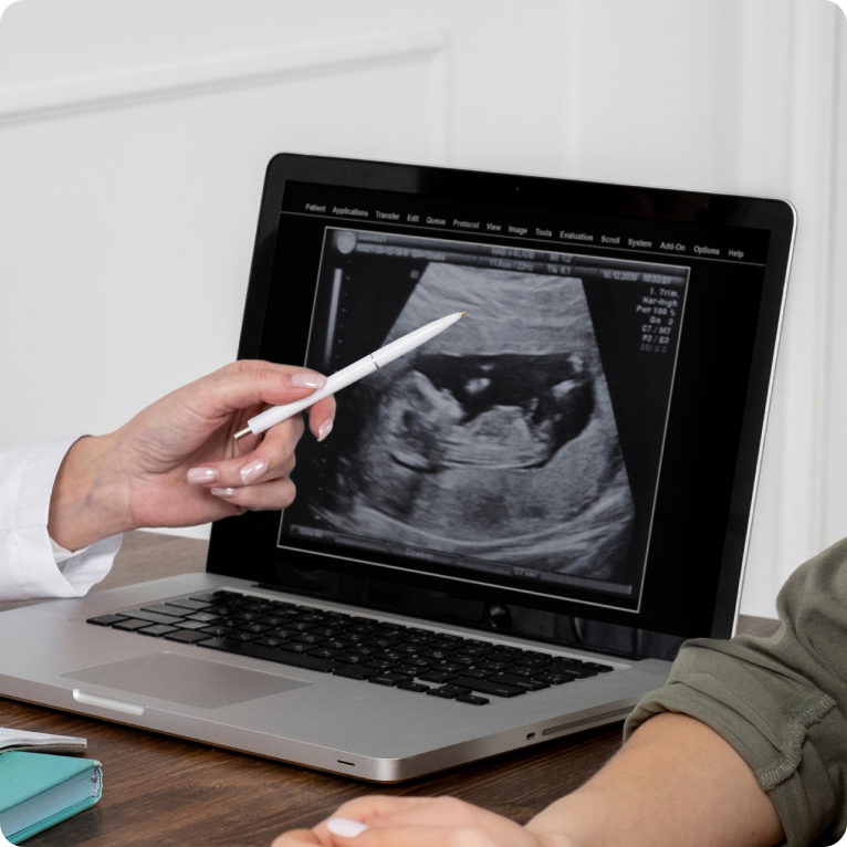 Fetal Echocardiography